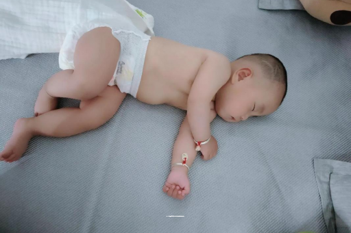 石嘴山六个月宝宝眼睛散光